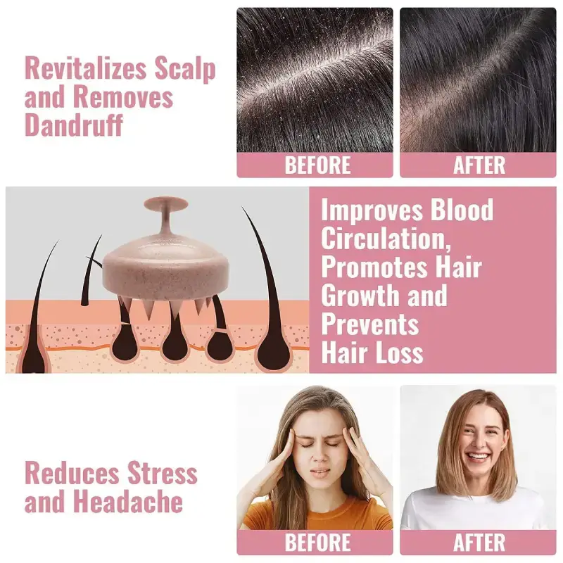 Shopsy Round Scalp Massager & Shampoo Brush with Soft Bristles Shopsy Round Scalp Massager & Shampoo Brush